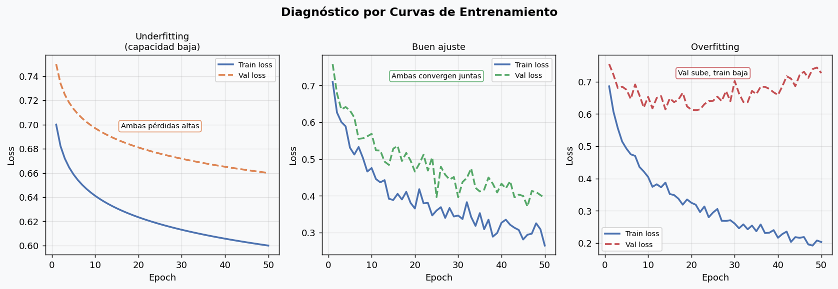 Curvas de entrenamiento — diagnostico